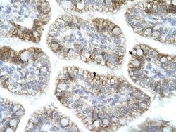 APBA1 Rabbit anti-Human, Rat, Polyclonal, Novus Biologicals:Antibodies:Primary